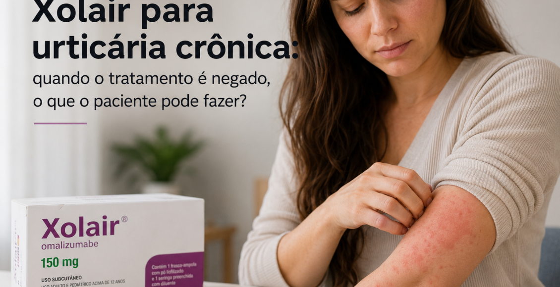 Xolair para urticária crônica: quando o tratamento é negado, o que o paciente pode fazer?