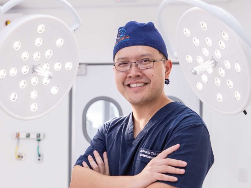 Body Hair Transplant: técnica usa pelos da barba para tratar calvície extensa