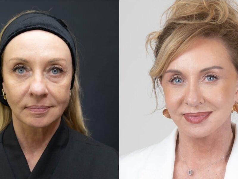 “Bem-vindos ao luxo”: facelift reforça imagem de corretora de alto padrão